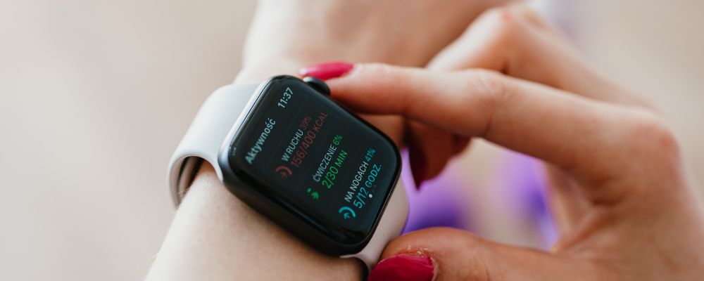 accesorios relojes inteligentes